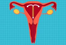 The Pros and Cons of Intrauterine Devices